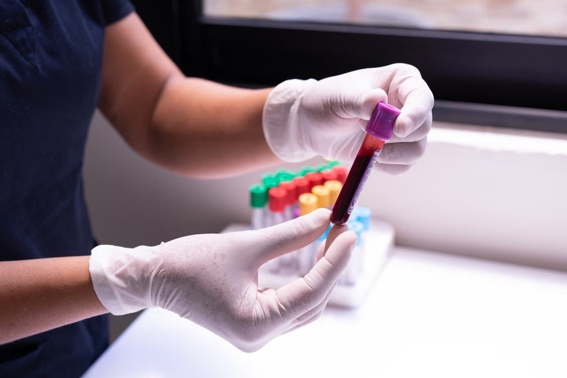 Blood Services